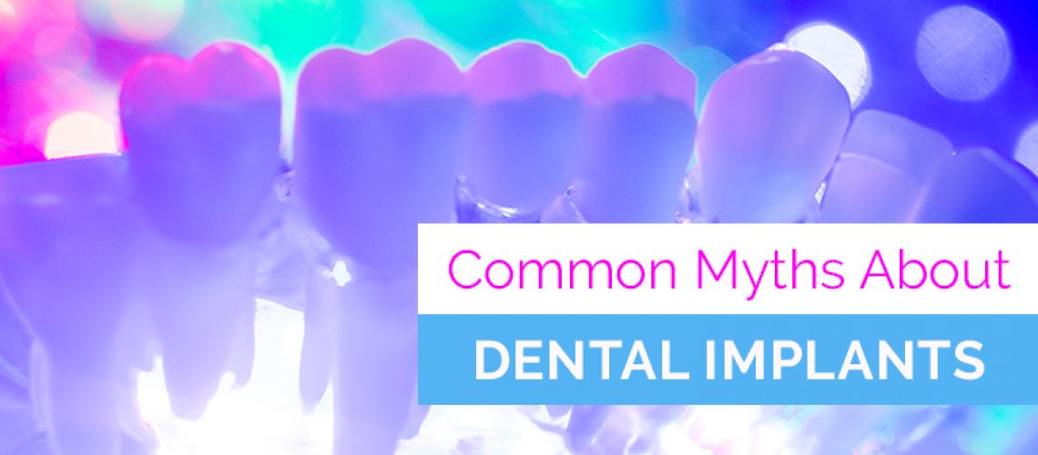 common-dental-implant-myths